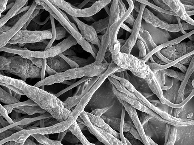 鋰電池爆炸頻發(fā) 新技術(shù)能0.4秒控制火情 鋰電池爆炸頻發(fā) 新技術(shù)能0.4秒控制火情